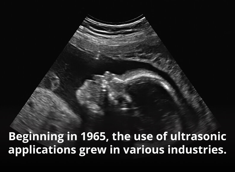 baby with ultrasound technology 